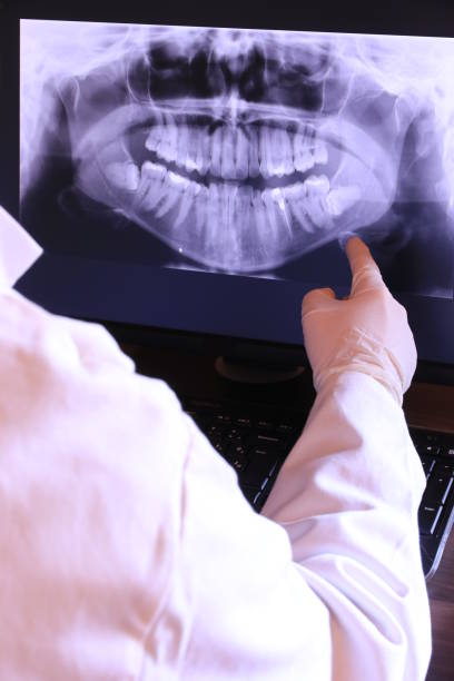 Best Tooth Pain Emergency Relief  in St Bonaventure, NY