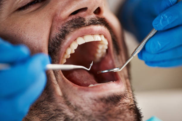 Dentist for Dental Trauma in NY